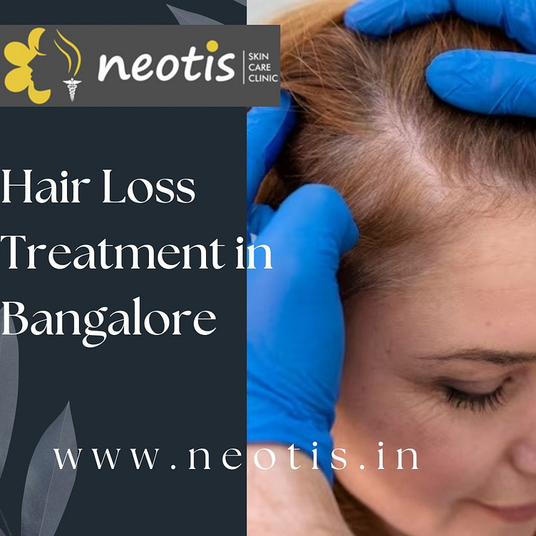 Hair Loss Treatment in BangaloreHair Fall Treatment by Rohan on Dribbble