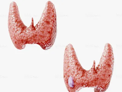 Healthy Thyroid and Thyroid Cancer 3D Model