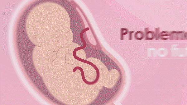 Motion Cuts 795 | MonkeyBusiness animation animation 2d animation after effects baby blood born illustration motion motion design motion graphics newborn science