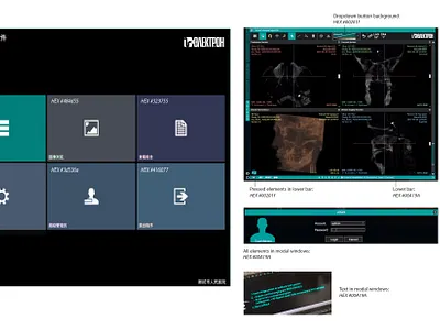 Marking areas of Angiography complex user interface, 2023