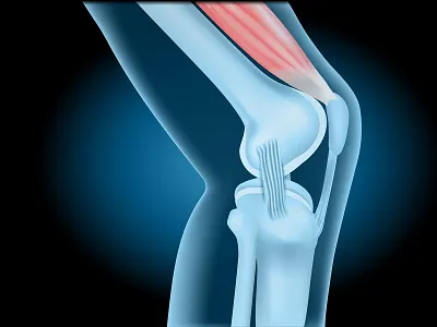 Knee joint with Quadriceps anatomy banner design education illustration joint medical muscle transparent x ray