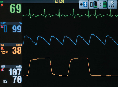 STRIKER Defibrillator Simulation adobe xd animation courseware instructional design interactive motion graphics ui