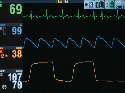 STRIKER Defibrillator Simulation adobe xd animation courseware instructional design interactive motion graphics ui