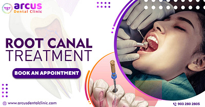 What is root canal treatment? best dental clinic in kphb dental hospital near me dental treatments kphb dentist in kphb