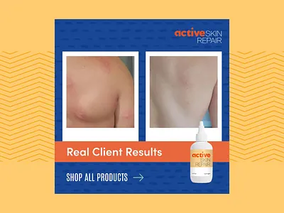 Active Skin Repair Meta Ad active skin repair advertising before and after branding campaign digital design facebook ads healing instagram meta meta ads natural healing ppc marketing product remarketing social media social strategy ui ux