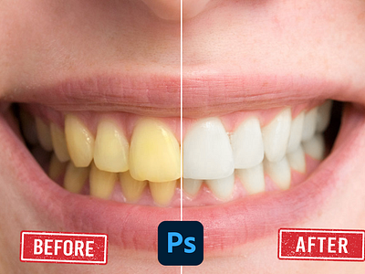 whiten teeth in 1 click 3d animation branding graphic design logo motion graphics ui whiten teeth