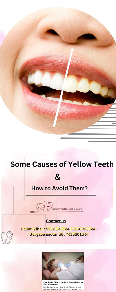 Best Kids Dentist in Gurgaon | Causes of Yellow Teeth- Firsttoot best kids dentist in gurgaon firsttoothclinic kids dentistry oral health