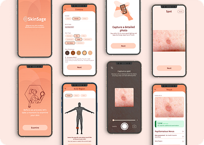 SkinSage- Skin disease detction D7 of UI challenge #SuperDribbbs ar disease skin ui vr