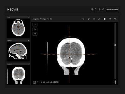 Medical Visualization Software medical software ui ux visualization