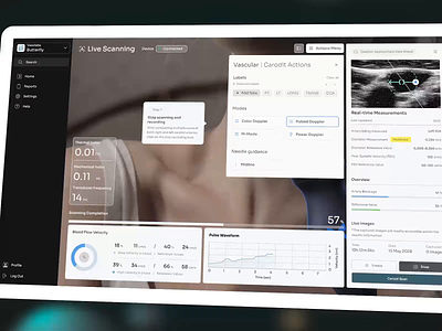 Medical Device Live Scanning animation blood pressure ui dashboard design digital agency interaction interface medical device medical device ui medical interface patient monitor scanner reports ui ux medical vasolab user interface