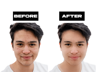 Male Face Retouch acne removal photo adobe photoshop after background removal before color change face face retouch graphic design image enhancement image processing image resizing photo photo retouching reshape retouch retouching enhancement social media design social media imagery transparent background