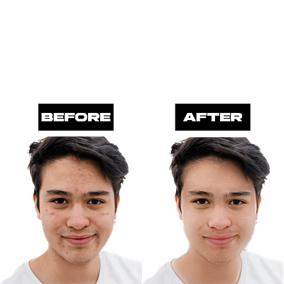 Male Face Retouch acne removal photo adobe photoshop after background removal before color change face face retouch graphic design image enhancement image processing image resizing photo photo retouching reshape retouch retouching enhancement social media design social media imagery transparent background