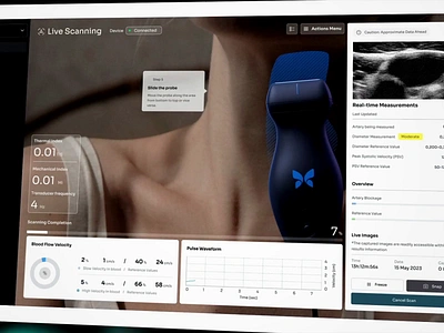 Medical Devices Healthcare Design Reel brain med device design clinical medical design dashboard dashboard ui diabetes device control digital health health data ui health tech health treatment interaction design medical app design medical design reel medical device interface medical technology design medtech animation patient monitor device ui design services ui for doctors ux medical welness user interface