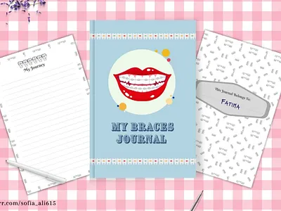 My Braces Journal amazon kdp animation blue book cover design braces journal clips dental health dentist design graphic design lined notebook lips logo mouth notebook teeth writing journey