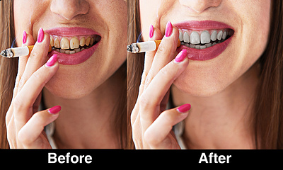 I will edit your teeth whiten , add smile or remove braces branding