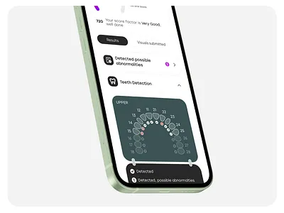 Dental Plus | Teeth Detection ai dental mobile app teeth ui ux ui