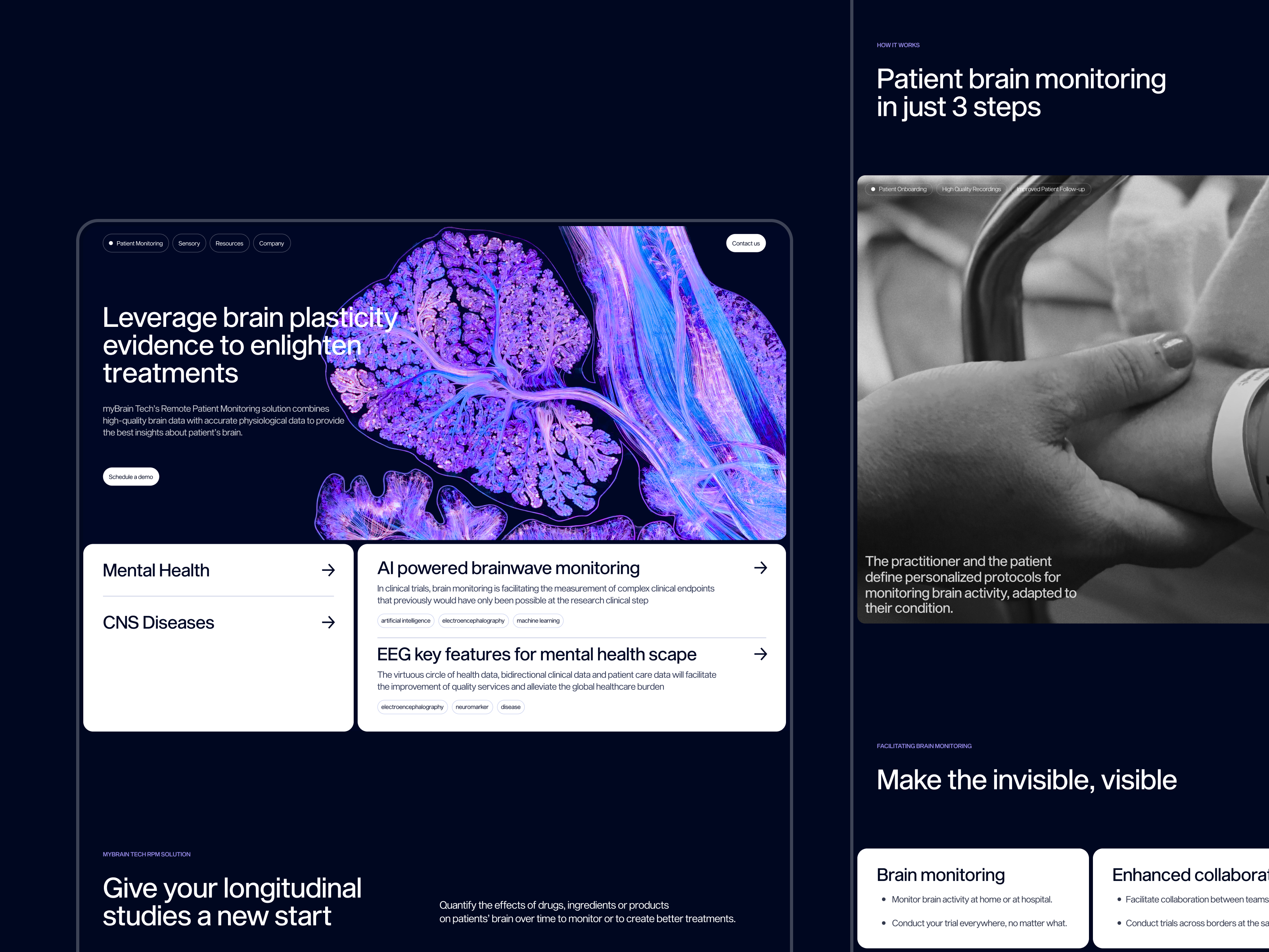 myBrain Tech | Remote Patient Monitoring anxiety brain eeg electroencephalography health interface medicine mental health neuroscience redesign stress ui web