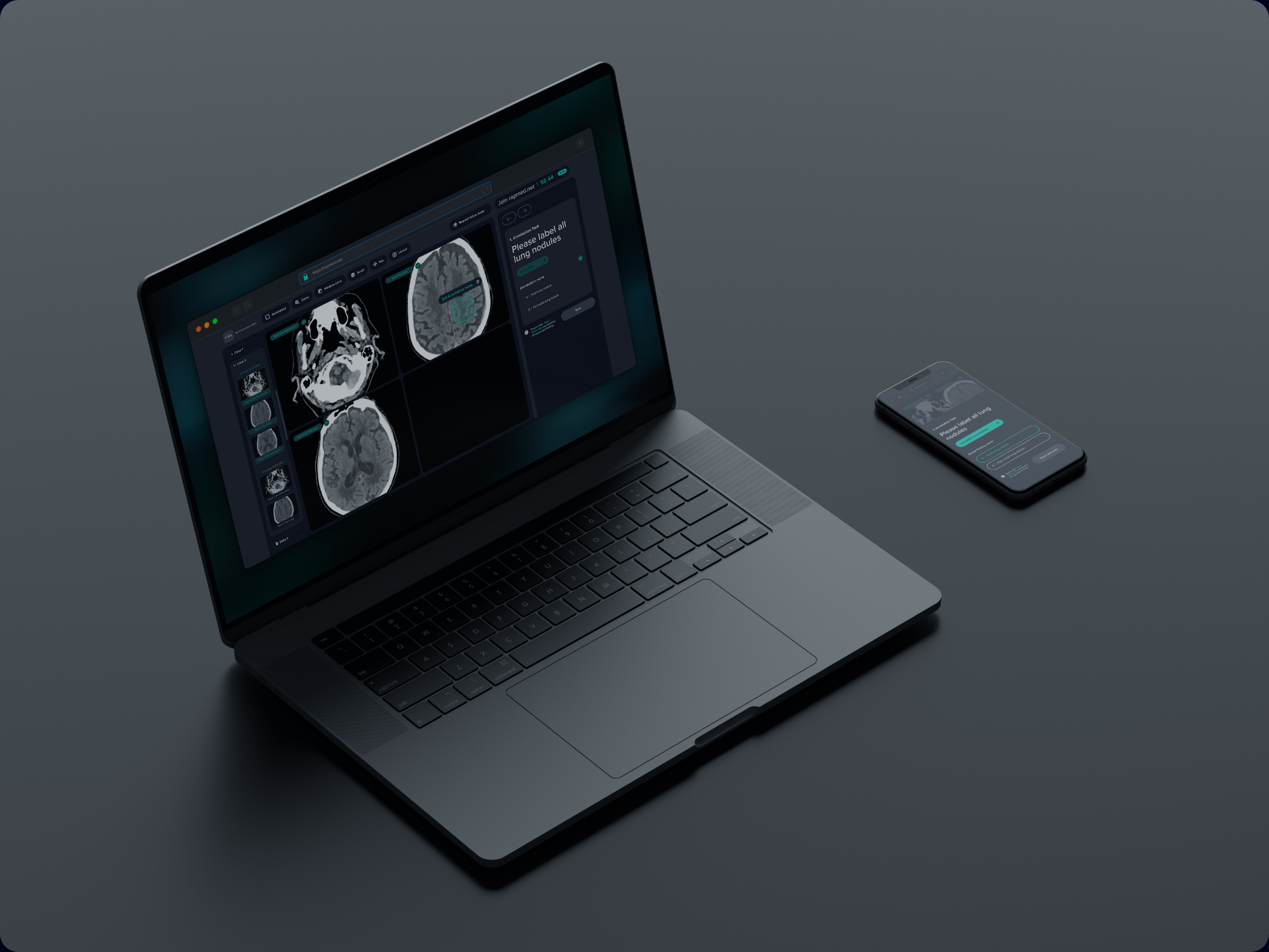 Medical tool application black branding graphic design green medical mobile ui ux web xray