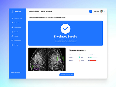 Breast Cancer Dashboard dashboard design dashboard ui figma figma freelance medical dashboard medical design medical ui medical ui design ui ui design uiux