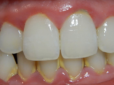 Teeth transformation doctor edit editing teeth transform