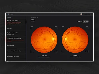 Medical Device - AEYE medical medical device ui ux