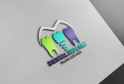 Dental Implant Logo2 animation dental implant logo2 graphic design logo motion graphics