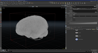 MRI Scan data visualised in 3D 3d houdini