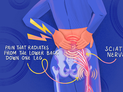 Back Pain back bone back pain biology body design health illustration medical illustration nerve pain procreate sciatica scientific spinal