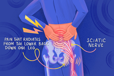 Back Pain back bone back pain biology body design health illustration medical illustration nerve pain procreate sciatica scientific spinal