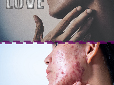 Skin retouching adobe photoshop graphic design retouching skin retouching