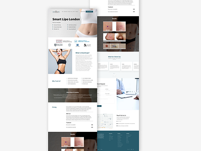 SmartLipo Wireframe Design figma landing page ui ux wireframe