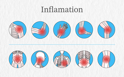 Inflamation illustration aoo bone bone marrow clinic disease icon illnes inflamation logo medical medicine pain student vector