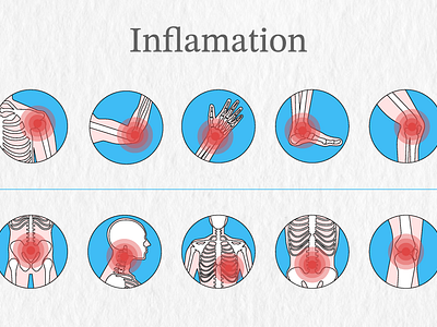 Inflamation illustration aoo bone bone marrow clinic disease icon illnes inflamation logo medical medicine pain student vector