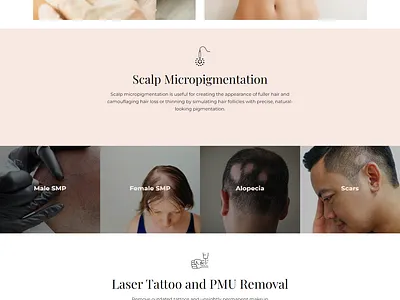 Scalp Micropigmentation Website Design ui