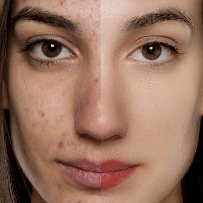 Skin High Retouching PROJECT photoshop skinhighretouching