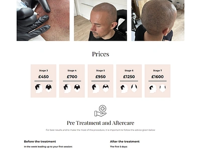 Scalp Micropigmentation Kent Website Design website design