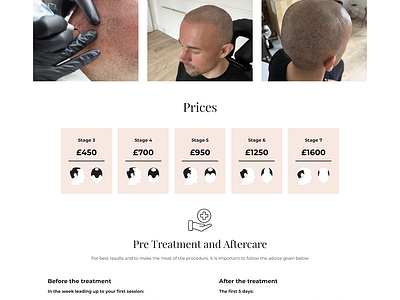 Scalp Micropigmentation Kent Website Design website design