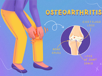 Osteoarthritis arthritis biomedical bone condition design health illustration inflammation joint medical osteoarthritis pain procreate senior