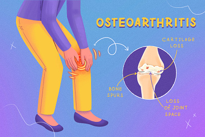 Osteoarthritis arthritis biomedical bone condition design health illustration inflammation joint medical osteoarthritis pain procreate senior