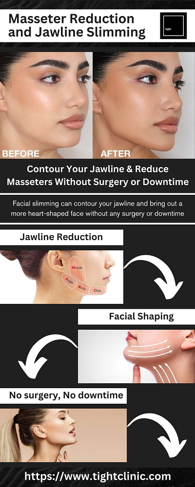 Refine Your Features - Non Surgical Jawline Contouring Toronto