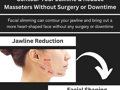 Refine Your Features - Non Surgical Jawline Contouring Toronto