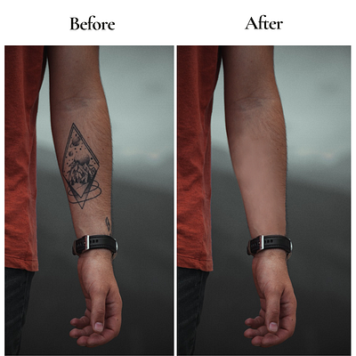 TATTOO REMOVAL adobe adobe photoshop branding editing graphic design photoshop poster removal retouching ui