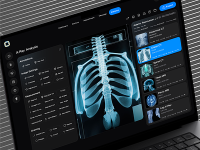 Humanex-AI : Advanced X-Ray Analysis with AI Precision 🩻 ai aibasedhealth artonest dashbord design designstudio futureofai futureofhealth healthcare healthtech logo ui ux