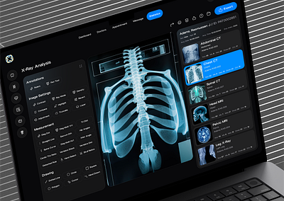 Humanex-AI : Advanced X-Ray Analysis with AI Precision 🩻 ai aibasedhealth artonest dashbord design designstudio futureofai futureofhealth healthcare healthtech logo ui ux