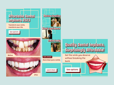 Dental Implants Banner Design banner design graphic design vector