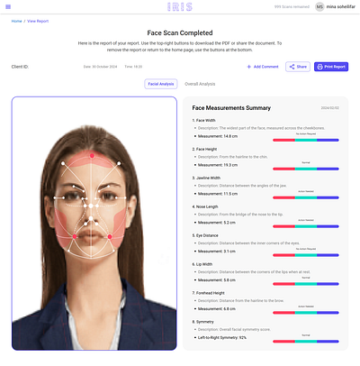 IRIS _ Front-End Develop vs Figma Design _ React Project develop