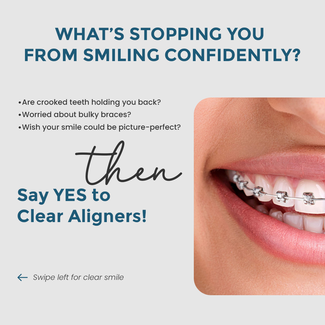Dental Clear Aligners Poster Design- NJWEBDESIGNING adobe dental poster photoshop poster
