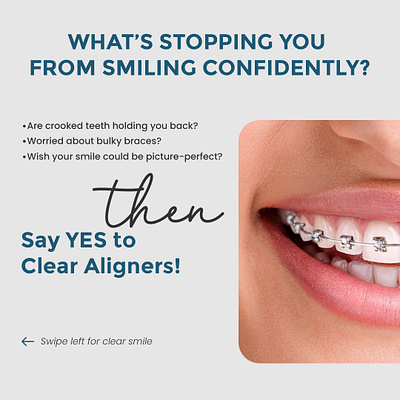 Dental Clear Aligners Poster Design- NJWEBDESIGNING adobe dental poster photoshop poster