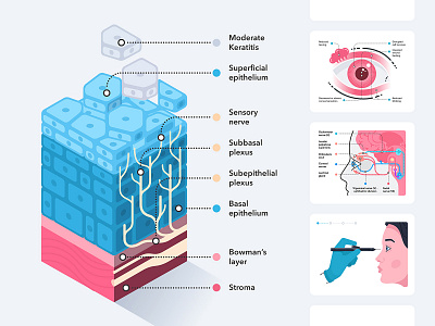 Medical infographic. Json Lottie web animations. 3d animated animation creative data visualization eye human cell illustrations infographic infographics information design isometric json lottie medical medicine nervs svg vector web