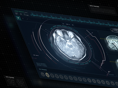 Neurovision - AI analyzing brain imaging data ai ai driven animation brain brain analysis design fui healthcare interface layout medical pacs scanning ui ux website